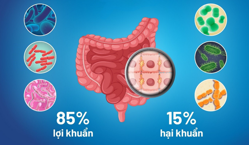 Men vi sinh nào tốt? Cách lựa chọn men vi sinh phù hợp
