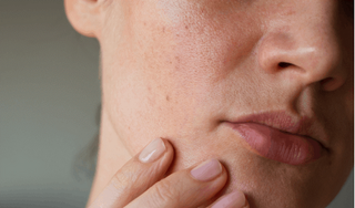 Da khô mùa đông: Làm sao để da mềm mịn hơn?