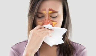Giảm nhanh ngạt mũi do viêm xoang từ thảo dược tự nhiên