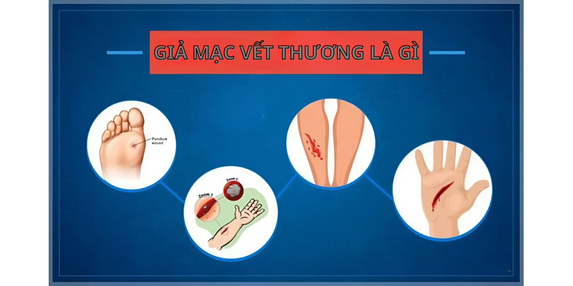 Giả mạc vết thương là gì: Tìm hiểu về lớp màng bảo vệ vết thương