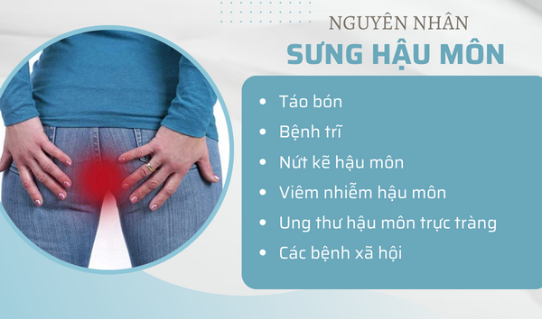 Cách chữa sưng hậu môn tại nhà hiệu quả và an toàn