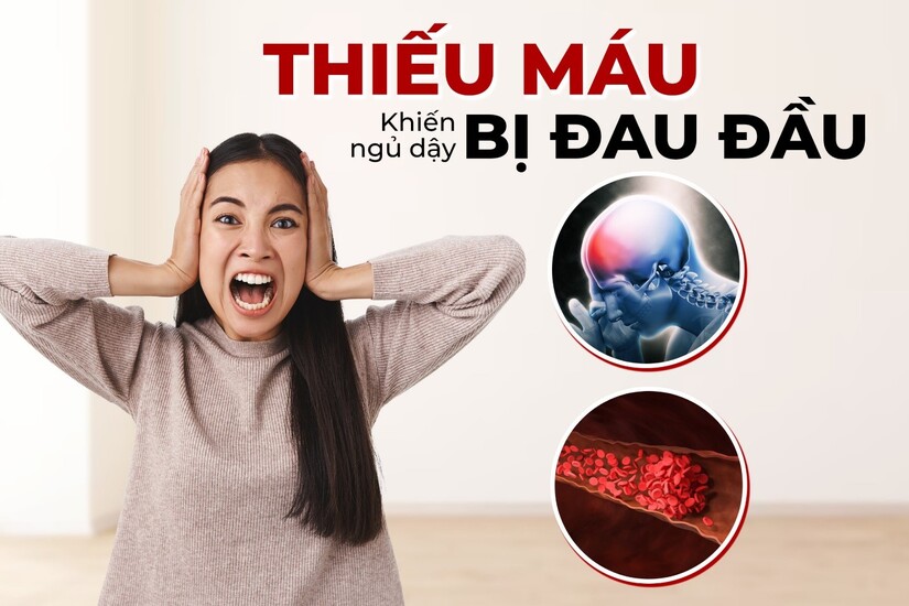 Đau đầu sau khi ngủ dậy: Nguyên nhân và cách khắc phục
