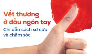Vết thương ở đầu ngón tay: Chỉ dẫn cách sơ cứu và chăm sóc