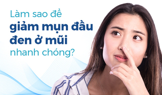 Làm sao để giảm mụn đầu đen ở mũi nhanh chóng?