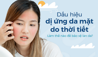 Dấu hiệu dị ứng da mặt do thời tiết: Làm thế nào để bảo vệ làn da?