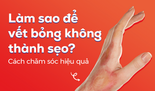 Làm sao để vết bỏng không thành sẹo? Cách chăm sóc hiệu quả