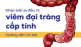 Nhận biết và điều trị viêm đại tràng cấp tính: Hướng dẫn chi tiết