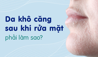 Da khô căng sau khi rửa mặt phải làm sao?