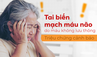 Tai biến mạch máu não do máu không lưu thông: Triệu chứng cảnh báo
