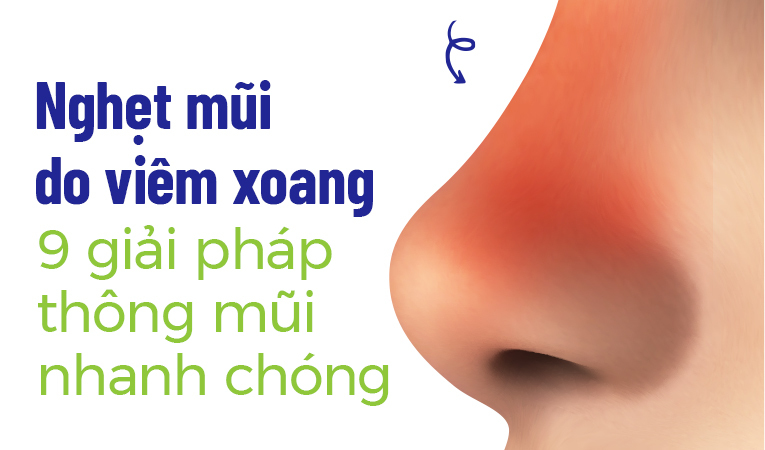 Nghẹt mũi do viêm xoang: 9 giải pháp thông mũi nhanh chóng