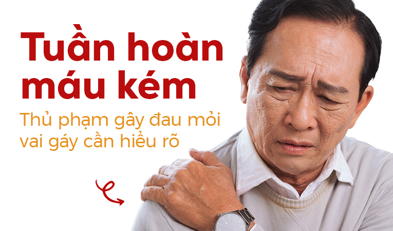 Tuần hoàn máu kém – Thủ phạm gây đau mỏi vai gáy cần hiểu rõ