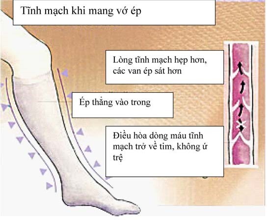 Nghẽn tĩnh mạch chân – Những điều cần biết để bảo vệ sức khỏe