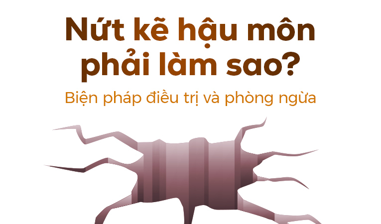 Nứt kẽ hậu môn phải làm sao? Biện pháp điều trị và phòng ngừa