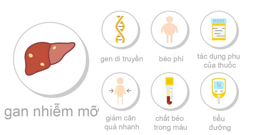 Gan nhiễm mỡ nhẹ: Những điều mà người bệnh cần biết