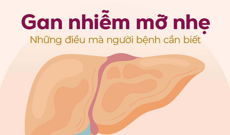 Gan nhiễm mỡ nhẹ: Những điều mà người bệnh cần biết