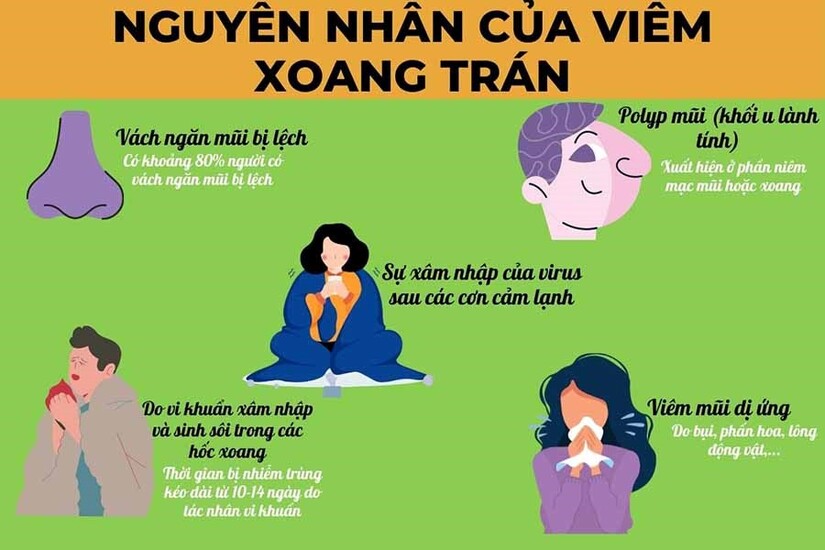 Nhận biết và điều trị viêm xoang trán mạn tính đúng cách