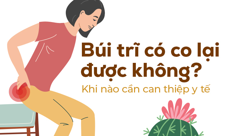 Búi trĩ có co lại được không? Khi nào cần can thiệp y tế