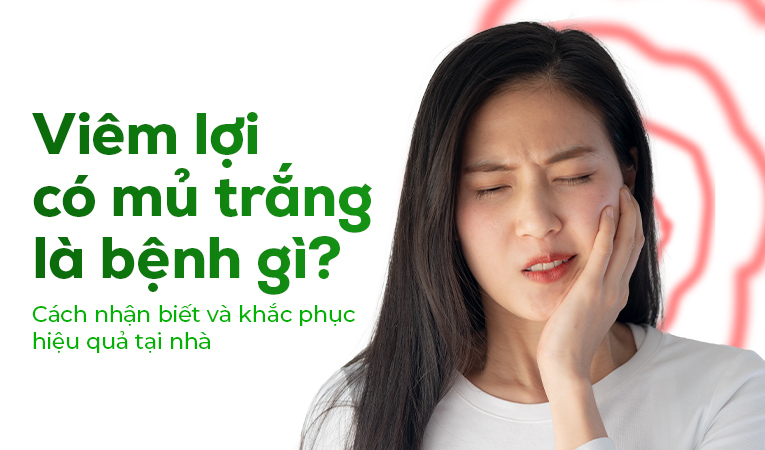 Viêm lợi có mủ trắng là bệnh gì? Cách nhận biết và khắc phục hiệu quả