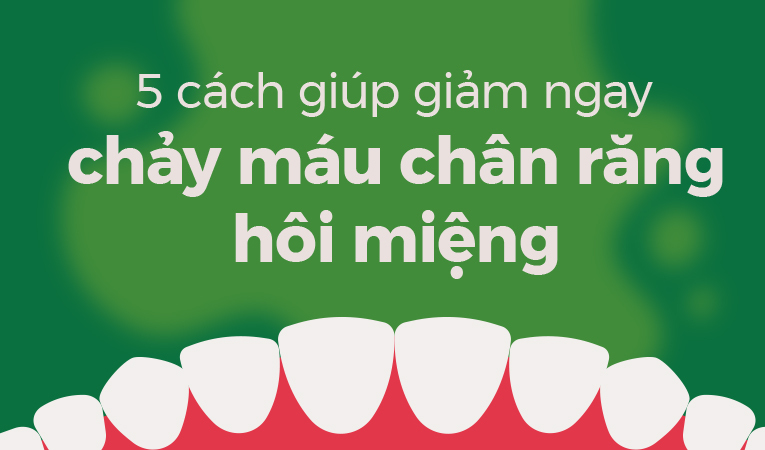 5 cách giúp giảm ngay chảy máu chân răng hôi miệng