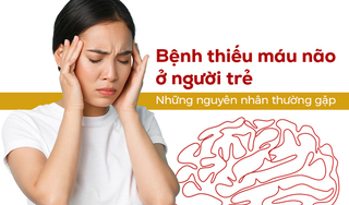 Bệnh thiếu máu não ở người trẻ: Những nguyên nhân thường gặp