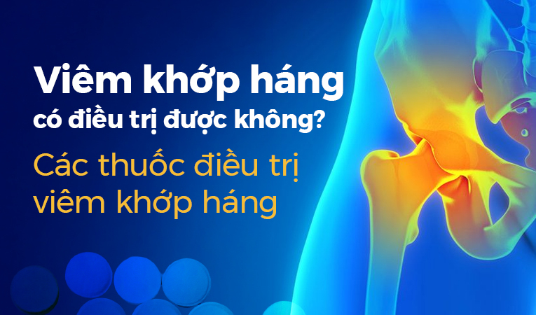 Viêm khớp háng có điều trị được không: Thuốc điều trị viêm khớp háng