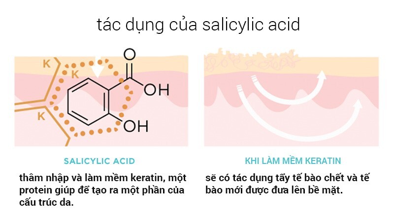 Da nhờn mụn nên dùng sữa rửa mặt gì? Lựa chọn hiệu quả cho làn da