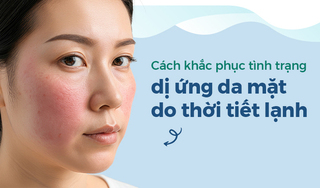 Cách khắc phục tình trạng dị ứng da mặt do thời tiết lạnh