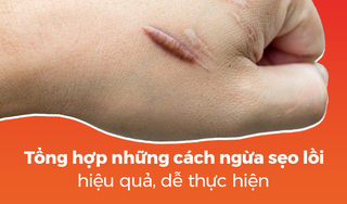 Tổng hợp những cách ngừa sẹo lồi hiệu quả, dễ thực hiện