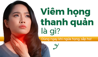 Viêm họng thanh quản là gì: Dùng ngay khi ngứa họng, sắp ho! 