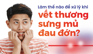 Làm thế nào để xử lý khi vết thương sưng mủ đau đớn?
