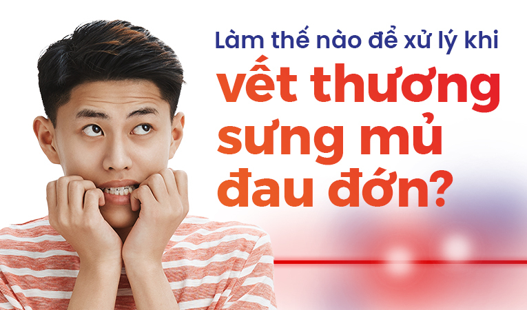 Làm thế nào để xử lý khi vết thương sưng mủ đau đớn?