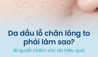 Da dầu lỗ chân lông to phải làm sao? Bí quyết chăm sóc da hiệu quả