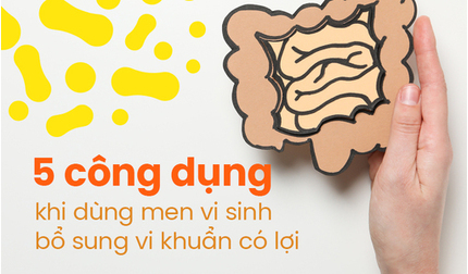 5 công dụng khi dùng men vi sinh bổ sung vi khuẩn có lợi 