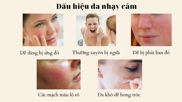 Dấu hiệu nhận biết và cách chăm sóc cho da nhạy cảm