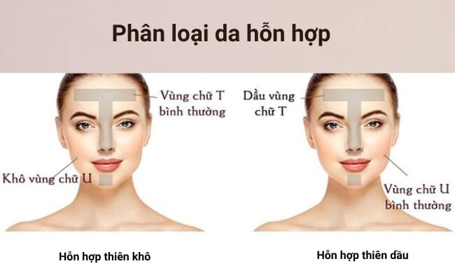 Cách chăm sóc da hỗn hợp bị mụn, giúp làn da luôn khỏe đẹp