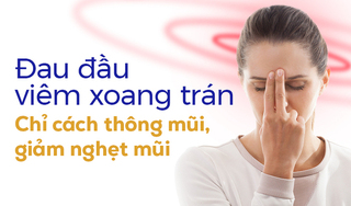Đau đầu viêm xoang trán: Chỉ cách thông mũi, giảm nghẹt mũi