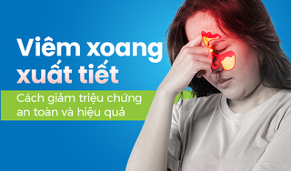 Viêm xoang xuất tiết: Cách giảm triệu chứng an toàn và hiệu quả