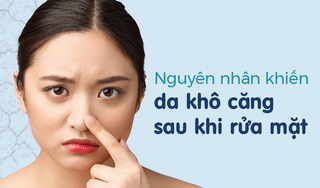 Nguyên nhân khiến da khô căng sau khi rửa mặt 