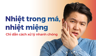 Nhiệt trong má, nhiệt miệng: Chỉ dẫn cách xử lý nhanh chóng