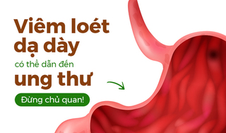 Viêm loét dạ dày có thể dẫn đến ung thư – Đừng chủ quan!