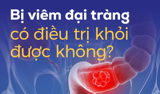 Bị viêm đại tràng có điều trị khỏi được không?