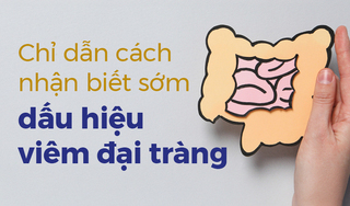 Chỉ dẫn cách nhận biết sớm dấu hiệu viêm đại tràng