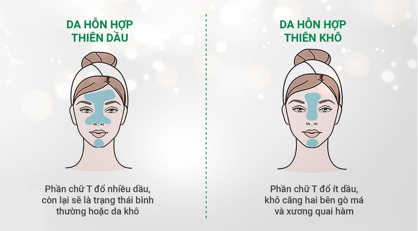 Da hỗn hợp nên dùng sữa rửa mặt nào? Những tiêu chí lựa chọn