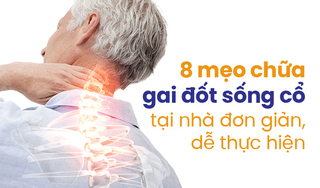 8 mẹo chữa gai đốt sống cổ tại nhà đơn giản, dễ thực hiện