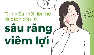 Tìm hiểu mối liên hệ và cách điều trị sâu răng viêm lợi