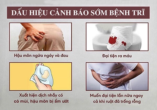 Trĩ nội độ 1 – Chăm sóc và điều trị sớm để phòng biến chứng