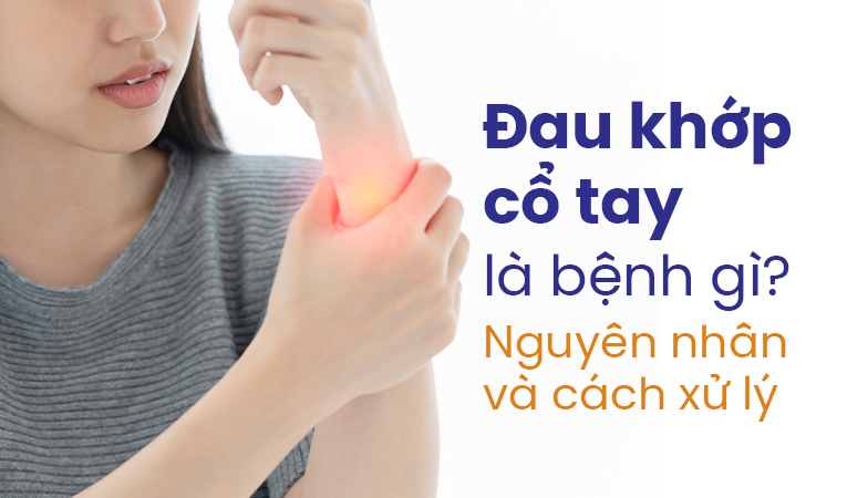 Đau khớp cổ tay là bệnh gì? Nguyên nhân và cách xử lý