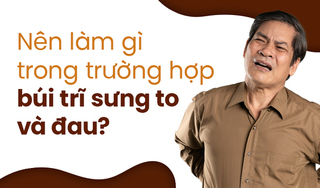 Nên làm gì trong trường hợp búi trĩ sưng to và đau?