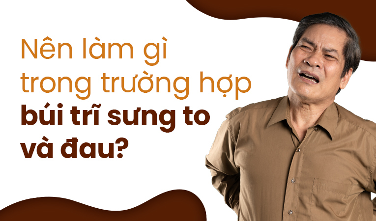 Nên làm gì trong trường hợp búi trĩ sưng to và đau?