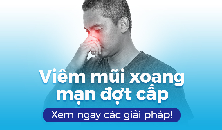 Viêm mũi xoang mạn đợt cấp: Xem ngay các giải pháp!